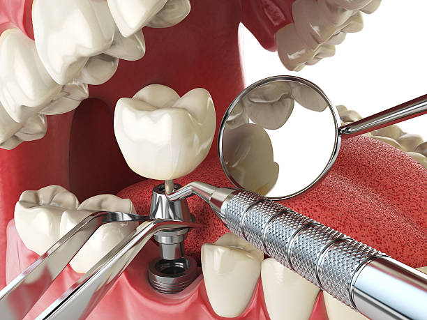 Best Emergency Treatment for Oral Infections in Medpolis, IA